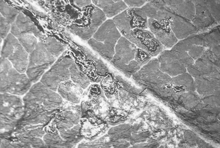 $publishedArticle->coverImageAltText