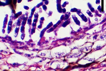 $publishedArticle->coverImageAltText